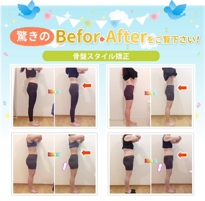 ビフォーアフター